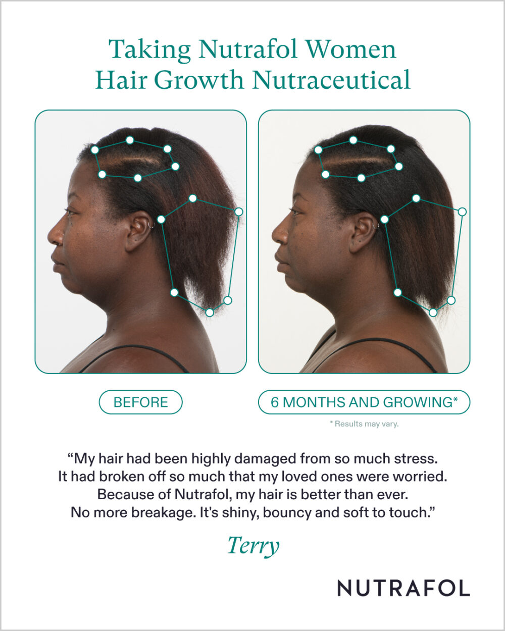 Nutrafol - Image 5