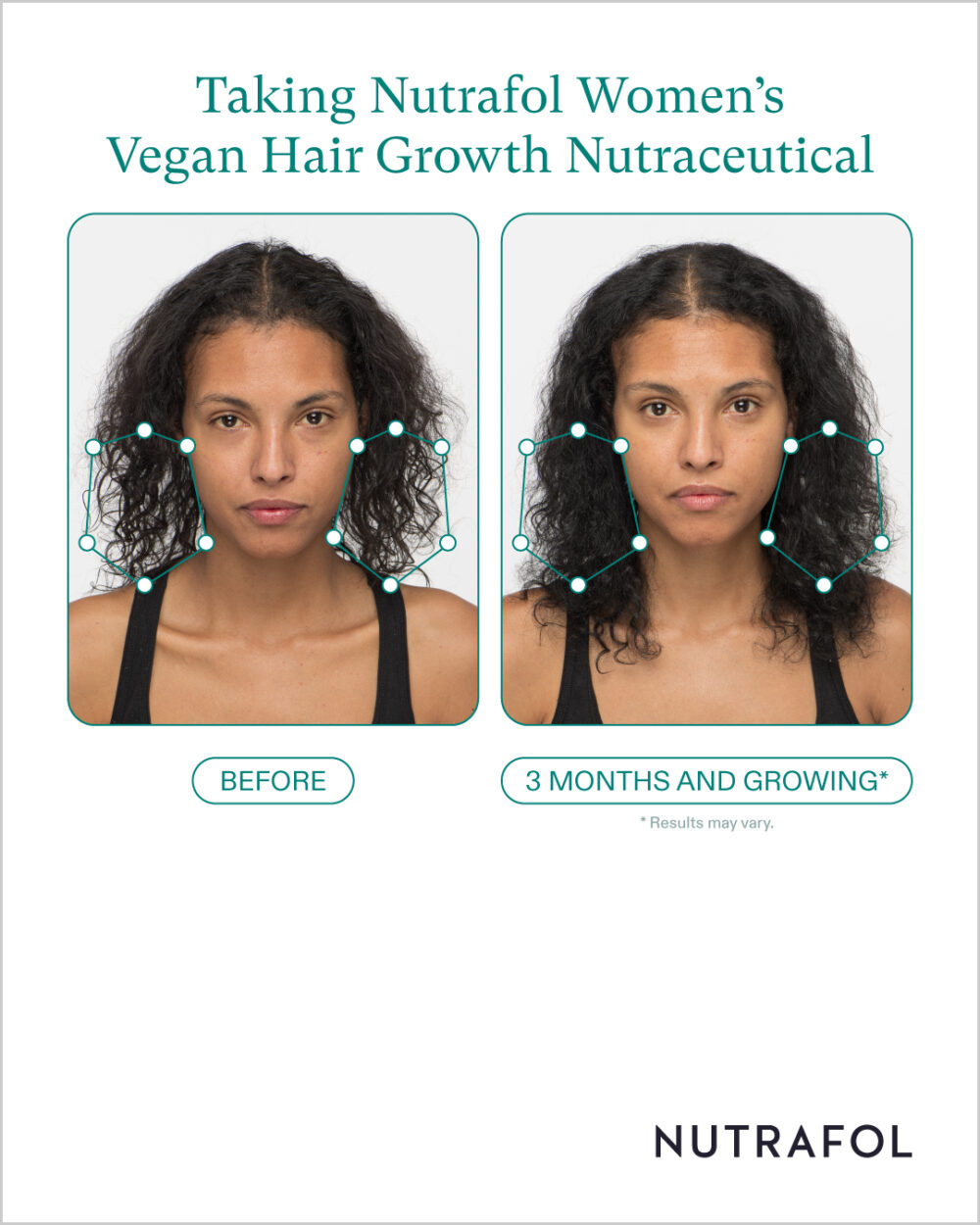 Nutrafol - Image 7